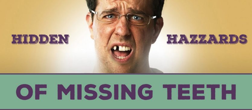 Hidden Hazards of Missing Teeth