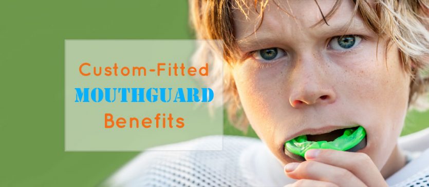 Custom-Fitted Mouthguard Benefits