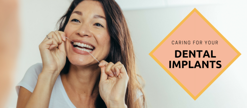 Caring for Your Dental Implants