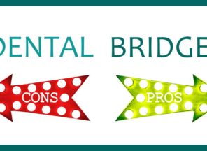Dental Bridges Pros Cons