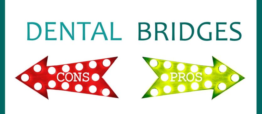 Dental Bridges Pros Cons