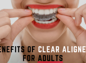 Benefits of Clear Aligners for Adults