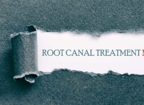 root canal myths