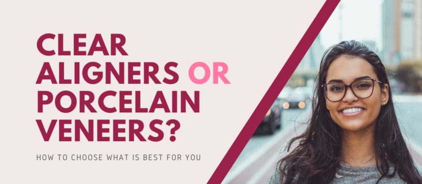 Clear Aligners or Porcelain Veneers?