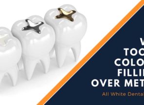 Why Tooth Colored Fillings Over Metal Fillings