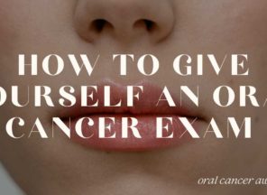 How To Give Yourself An Oral Cancer Exam