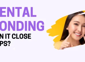 Dental Bonding Blog Header