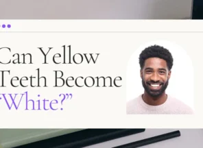 Yellow Teeth Blog Header
