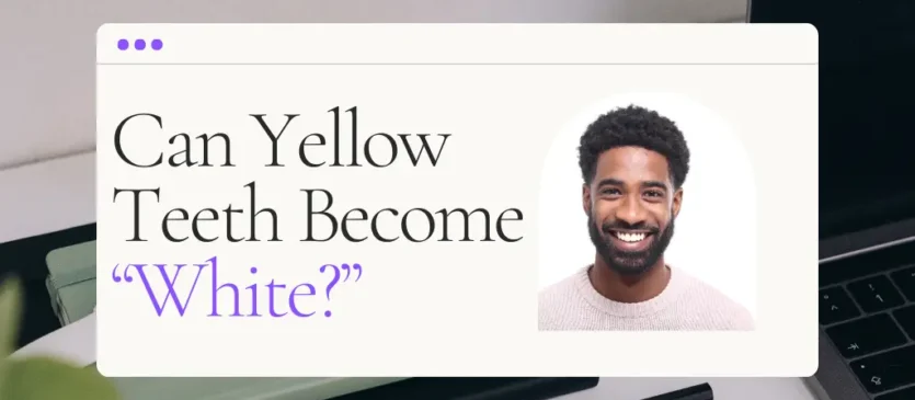 Yellow Teeth Blog Header