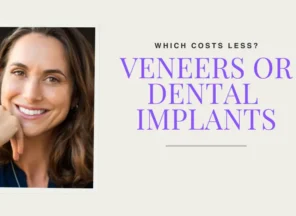 Veneers or Implants Blog Header