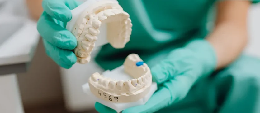 Dentist Showing Cosmetic Teeth Molds